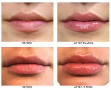 Load image into Gallery viewer, Lip Plumping Treatment with SPF 30