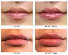 Load image into Gallery viewer, Lip Plumping Treatment with SPF 30
